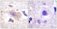 GRB10 Antibody - Immunohistochemistry analysis of paraffin-embedded human brain tissue, using GRB10 Antibody. The picture on the right is blocked with the synthesized peptide.