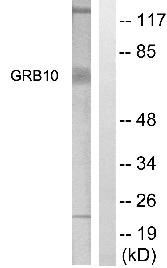 GRB10 Antibody - Western blot analysis of lysates from NIH/3T3 cells, treated with Insulin 0.01U/ml 15', using GRB10 Antibody. The lane on the right is blocked with the synthesized peptide.