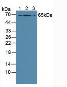 GRB10 Antibody - Western Blot; Sample: Lane1: Human Lung Tissue; Lane2: Human Hela Cells; Lane3: Mouse Brain Tissue.