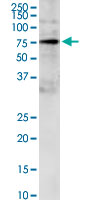 GRB10 Antibody - GRB10 monoclonal antibody (M01), clone 1A7. Western Blot analysis of GRB10 expression in IMR-32.