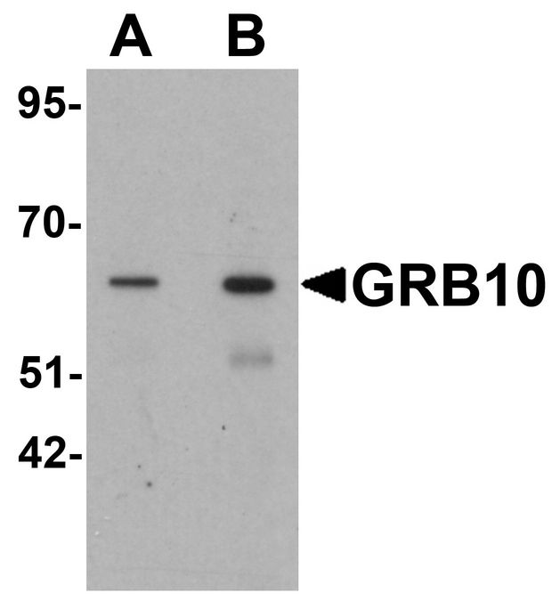 GRB10 Antibody - Western blot analysis of GRB10 in SK-N-SH cell lysate with GRB10 antibody at (A) 1 and (B) 2 ug/ml.
