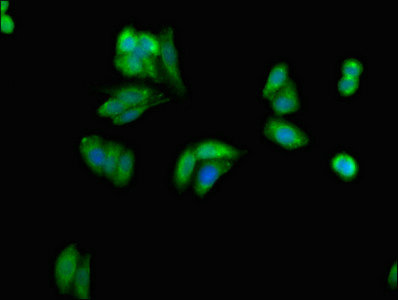 GRB10 Antibody - Immunofluorescent analysis of HepG2 cells at a dilution of 1:100 and Alexa Fluor 488-congugated AffiniPure Goat Anti-Rabbit IgG(H+L)