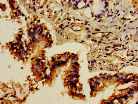 GRB10 Antibody - Immunohistochemistry image of paraffin-embedded human lung tissue at a dilution of 1:100
