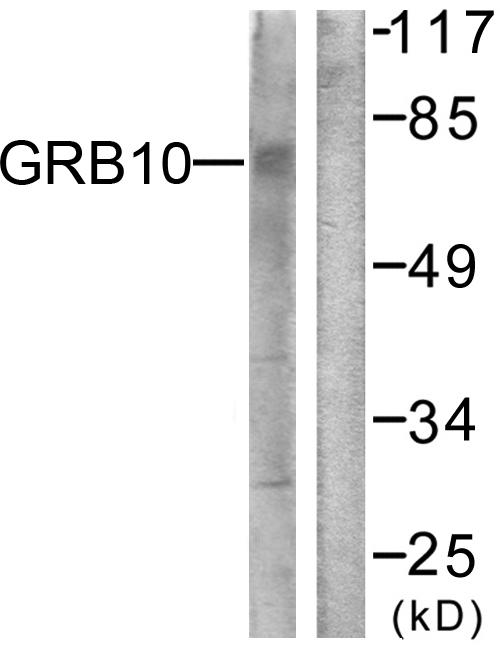 GRB10 Antibody - Western blot analysis of extracts from NIH/3T3 cells, treated with Insulin (0.01U/ml, 15mins), using GRB10 (Ab-67) antibody.