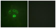 GRB10 Antibody - Immunofluorescence analysis of HepG2 cells, using GRB10 (Phospho-Tyr67) Antibody. The picture on the right is blocked with the phospho peptide.