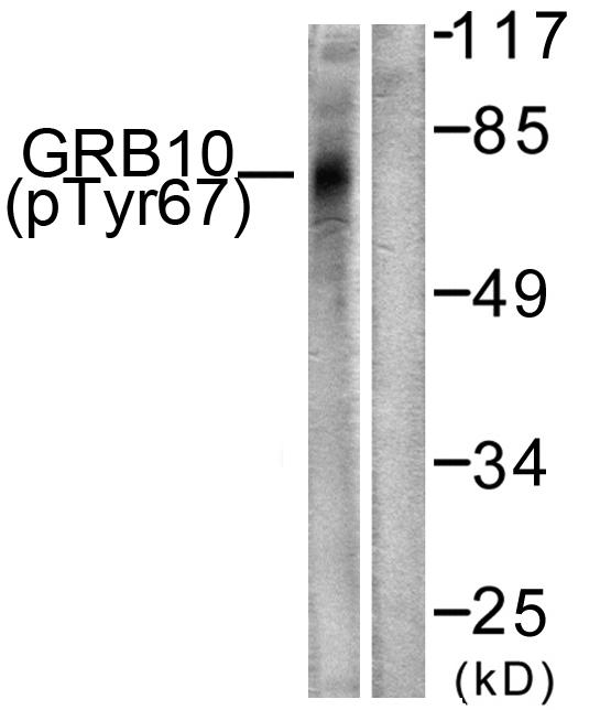 GRB10 Antibody - Western blot analysis of lysates from NIH/3T3 cells treated with Insulin 0.01U/ml 15', using GRB10 (Phospho-Tyr67) Antibody. The lane on the right is blocked with the phospho peptide.