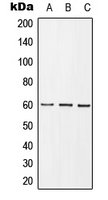 GRB10 Antibody - Western blot analysis of GRB10 (pY67) expression in HEK293T insulin-treated (A); mouse spleen (B); PC12 insulin-treated (C) whole cell lysates.