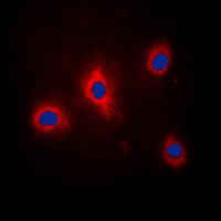 GRB10 Antibody - Immunofluorescent analysis of GRB10 (pY67) staining in PC12 cells. Formalin-fixed cells were permeabilized with 0.1% Triton X-100 in TBS for 5-10 minutes and blocked with 3% BSA-PBS for 30 minutes at room temperature. Cells were probed with the primary antibody in 3% BSA-PBS and incubated overnight at 4 C in a humidified chamber. Cells were washed with PBST and incubated with a DyLight 594-conjugated secondary antibody (red) in PBS at room temperature in the dark. DAPI was used to stain the cell nuclei (blue).