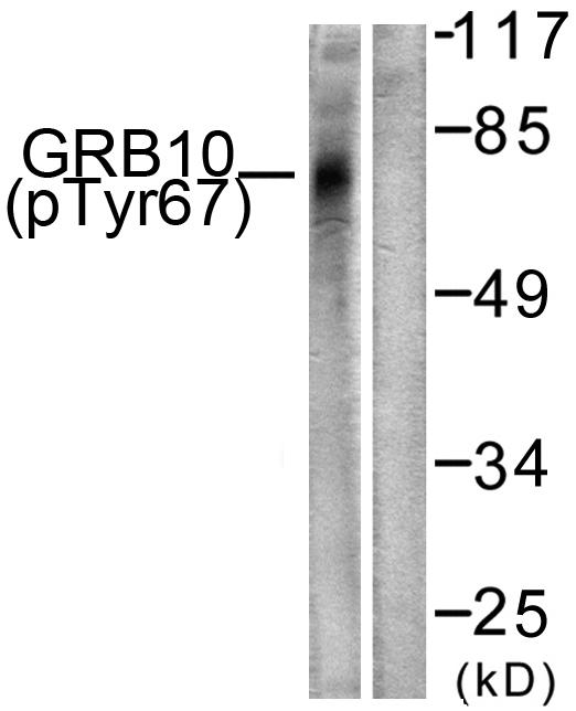 GRB10 Antibody - Western blot analysis of extracts from NIH/3T3 cells, treated with Insulin (0.01U/ml, 15mins), using GRB10 (Phospho-Tyr67) antibody.
