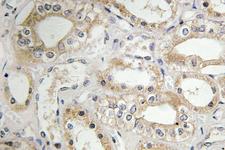 GRB14 Antibody - IHC of GRB14 (D123) pAb in paraffin-embedded human kidney tissue.