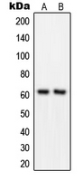 GRB14 Antibody - Western blot analysis of GRB14 expression in MOLT4 (A); COLO205 (B) whole cell lysates.