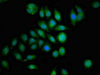 GRB14 Antibody - Immunofluorescence staining of A549 cells at a dilution of 1:133, counter-stained with DAPI. The cells were fixed in 4% formaldehyde, permeabilized using 0.2% Triton X-100 and blocked in 10% normal Goat Serum. The cells were then incubated with the antibody overnight at 4 °C.The secondary antibody was Alexa Fluor 488-congugated AffiniPure Goat Anti-Rabbit IgG (H+L) .