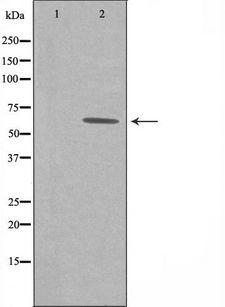 GRB14 Antibody - Western blot analysis of extracts of COLO cells using GRB14 antibody.