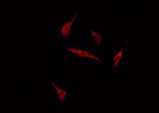 GRB14 Antibody - Staining HuvEc cells by IF/ICC. The samples were fixed with PFA and permeabilized in 0.1% Triton X-100, then blocked in 10% serum for 45 min at 25°C. The primary antibody was diluted at 1:200 and incubated with the sample for 1 hour at 37°C. An Alexa Fluor 594 conjugated goat anti-rabbit IgG (H+L) antibody, diluted at 1/600, was used as secondary antibody.