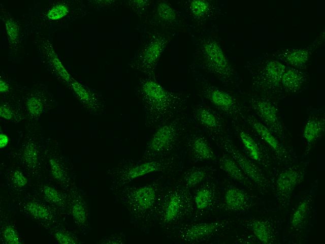 GRB14 Antibody - Immunofluorescence staining of GRB14 in U2OS cells. Cells were fixed with 4% PFA, permeabilzed with 0.1% Triton X-100 in PBS, blocked with 10% serum, and incubated with rabbit anti-Human GRB14 polyclonal antibody (dilution ratio 1:100) at 4°C overnight. Then cells were stained with the Alexa Fluor 488-conjugated Goat Anti-rabbit IgG secondary antibody (green). Positive staining was localized to Nucleus and Cytoplasm.