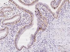 GRB14 Antibody - Immunochemical staining of human GRB14 in human gallbladder with rabbit polyclonal antibody at 1:500 dilution, formalin-fixed paraffin embedded sections.
