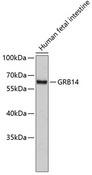 GRB14 Antibody - Western blot analysis of extracts of human fetal intestine using GRB14 Polyclonal Antibody.