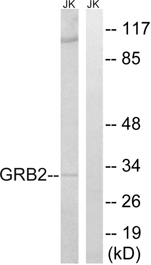 GRB2 Antibody - Western blot analysis of lysates from Jurkat cells, using GRB2 Antibody. The lane on the right is blocked with the synthesized peptide.