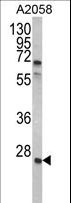 GRB2 Antibody - Western blot of GRB2 Antibody in A2058 cell line lysates (35 ug/lane). GRB2 (arrow) was detected using the purified antibody.