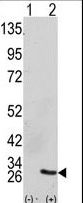 GRB2 Antibody - Western blot of GRB2 (arrow) using GRB2 Antibody. 293 cell lysates (2 ug/lane) either nontransfected (Lane 1) or transiently transfected with the GRB2 gene (Lane 2) (Origene Technologies).