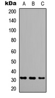 GRB2 Antibody - Western blot analysis of GRB2 expression in HeLa (A); SHSY5Y (B); rat muscle (C) whole cell lysates.