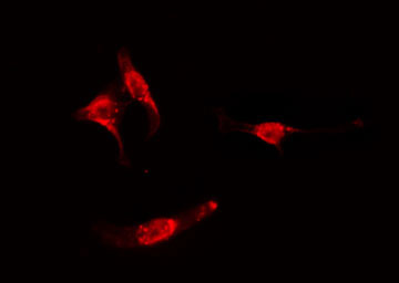 GRB2 Antibody - Staining HeLa cells by IF/ICC. The samples were fixed with PFA and permeabilized in 0.1% Triton X-100, then blocked in 10% serum for 45 min at 25°C. The primary antibody was diluted at 1:200 and incubated with the sample for 1 hour at 37°C. An Alexa Fluor 594 conjugated goat anti-rabbit IgG (H+L) antibody, diluted at 1/600, was used as secondary antibody.