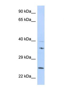 GRB2 Antibody - GRB2 antibody Western blot of 721_B Cell lysate. Antibody concentration 1 ug/ml.  This image was taken for the unconjugated form of this product. Other forms have not been tested.
