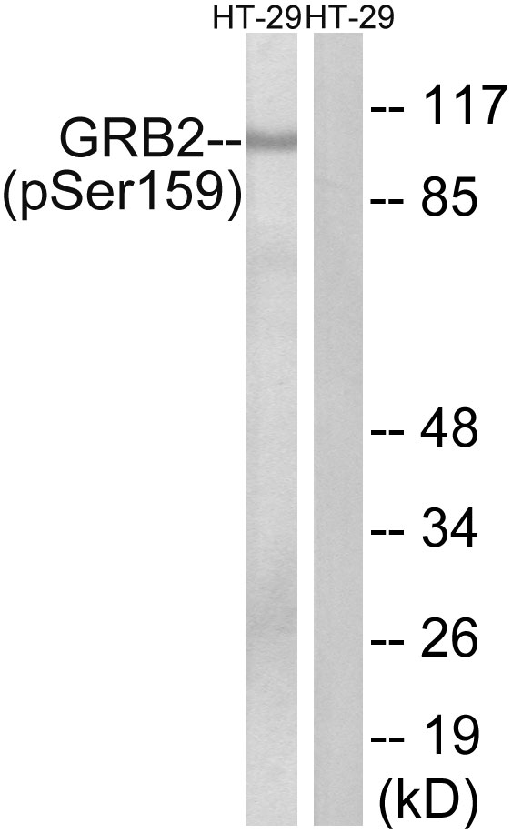 GRB2 Antibody - Western blot analysis of lysates from HT29 cells treated with serum 20% 15', using GRB2 (Phospho-Ser159) Antibody. The lane on the right is blocked with the phospho peptide.
