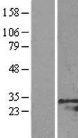 GRB2 Protein - Western validation with an anti-DDK antibody * L: Control HEK293 lysate R: Over-expression lysate
