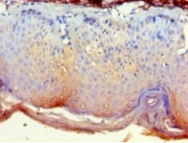 GRB4 / NCK2 Antibody - Immunohistochemistry of paraffin-embedded human skin using antibody at 1:100 dilution.  This image was taken for the unconjugated form of this product. Other forms have not been tested.