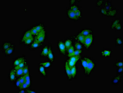 GRB4 / NCK2 Antibody - Immunofluorescent analysis of HepG2 cells using NCK2 Antibody at dilution of 1:100 and Alexa Fluor 488-congugated AffiniPure Goat Anti-Rabbit IgG(H+L)