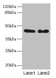 GRB4 / NCK2 Antibody - Western blot All lanes: Cytoplasmic protein NCK2 antibody at 8µg/ml Lane 1: Mouse brain tissue Lane 2: Mouse kidney tissue Secondary Goat polyclonal to rabbit IgG at 1/10000 dilution Predicted band size: 43 kDa Observed band size: 43 kDa