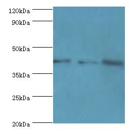 GRB4 / NCK2 Antibody - Western blot. All lanes: NCK2 antibody at 10 ug/ml. Lane 1: mouse spleen tissue. Lane 2: mouse brain tissue. Lane 3: mouse kidney tissue. Secondary antibody: Goat polyclonal to rabbit at 1:10000 dilution. Predicted band size: 43 kDa. Observed band size: 43 kDa Immunohistochemistry.