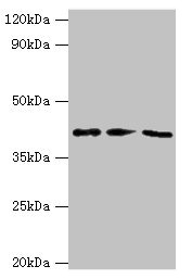 GRB4 / NCK2 Antibody - Western blot All lanes: NCK2 antibody at 10µg/ml Lane 1: Mouse spleen tissue Lane 2: Mouse brain tissue Lane 3: Mouse kidney tissue Secondary Goat polyclonal to rabbit IgG at 1/10000 dilution Predicted band size: 43 kDa Observed band size: 43 kDa