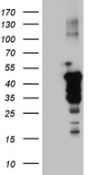 GRB4 / NCK2 Antibody - HEK293T cells were transfected with the pCMV6-ENTRY control. (Left lane) or pCMV6-ENTRY NCK2. (Right lane) cDNA for 48 hrs and lysed