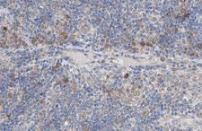 GRB4 / NCK2 Antibody - 1:100 staining human lymph node tissue by IHC-P. The tissue was formaldehyde fixed and a heat mediated antigen retrieval step in citrate buffer was performed. The tissue was then blocked and incubated with the antibody for 1.5 hours at 22°C. An HRP conjugated goat anti-rabbit antibody was used as the secondary.