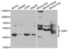 GRB7 Antibody - Western blot analysis of extracts of various cell lines.