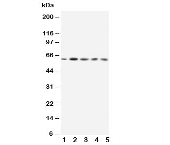 GRB7 Antibody - Western blot testing of GRB7 antibody and Lane 1: rat testis; 2: SMMC-7721; 3: HeLa; 4: A549; 5: SW620; Predicted size: 60KD; Observed size: 60KD