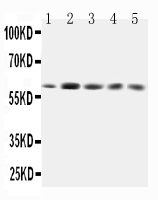 GRB7 Antibody - Anti-GRB7 antibody, All Western blotting All lanes: Anti-GRB7 at 0.5ug/ml Lane 1: Rat Testis Tissue Lysate at 40ug Lane 2: SMMC Whole Cell Lysate at 40ug Lane 3: HELA Whole Cell Lysate at 40ug Lane 4: A549 Whole Cell Lysate at 40ug Lane 5: SW620 Whole Cell Lysate at 40ug Predicted bind size: 60KD Observed bind size: 60KD