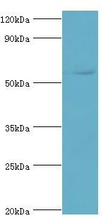 GRB7 Antibody - Western blot. All lanes: Growth factor receptor-bound protein 7 antibody at 2 ug/ml+rat brain tissue. Secondary antibody: Goat polyclonal to rabbit at 1:10000 dilution. Predicted band size: 60 kDa. Observed band size: 60 kDa Immunohistochemistry.