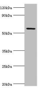 GRB7 Antibody - Western blot All lanes: Growth factor receptor-bound protein 7 antibody at 2µg/ml + Rat brain tissue Secondary Goat polyclonal to rabbit IgG at 1/10000 dilution Predicted band size: 60, 50, 63, 56 kDa Observed band size: 60 kDa