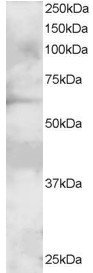 GRB7 Antibody - Antibody staining (2 ug/ml) of A431 lysate (RIPA buffer, 30 ug total protein per lane). Primary incubated for 1 hour. Detected by Western blot of chemiluminescence.