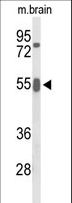 GRB7 Antibody - Western blot of GRB7 Antibody in mouse brain tissue lysates (35 ug/lane). GRB7 (arrow) was detected using the purified antibody.