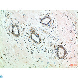 GRB7 Antibody - Immunohistochemical analysis of paraffin-embedded human-breast, antibody was diluted at 1:100.