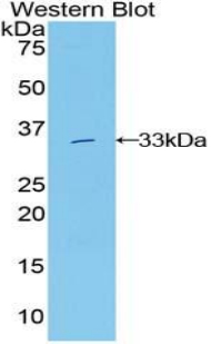 GRB7 Antibody - Western blot of recombinant GRB7.  This image was taken for the unconjugated form of this product. Other forms have not been tested.