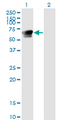 GRB7 Antibody - Western Blot analysis of GRB7 expression in transfected 293T cell line by GRB7 monoclonal antibody (M03), clone 3C12.Lane 1: GRB7 transfected lysate(59.7 KDa).Lane 2: Non-transfected lysate.