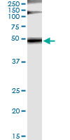 GRB7 Antibody - Immunoprecipitation of GRB7 transfected lysate using anti-GRB7 monoclonal antibody and Protein A Magnetic Bead, and immunoblotted with GRB7 rabbit polyclonal antibody.