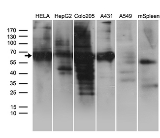 GRB7 Antibody - Western blot analysis of extracts. (35ug) from 5 different cell lines and mouse spleen tissue lysate by using anti-GRB7 monoclonal antibody. (1:500)