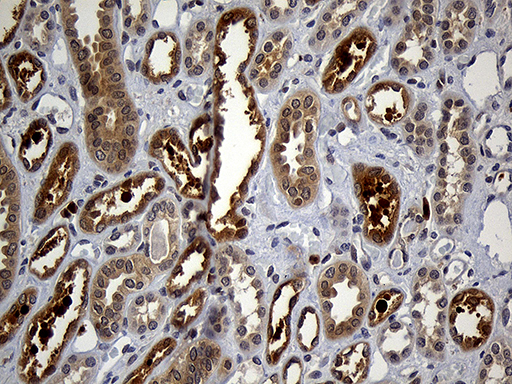GRB7 Antibody - Immunohistochemical staining of paraffin-embedded Human Kidney tissue within the normal limits using anti-GRB7 mouse monoclonal antibody. (Heat-induced epitope retrieval by 1mM EDTA in 10mM Tris buffer. (pH8.5) at 120°C for 3 min. (1:2000)
