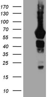 GRB7 Antibody - HEK293T cells were transfected with the pCMV6-ENTRY control. (Left lane) or pCMV6-ENTRY GRB7. (Right lane) cDNA for 48 hrs and lysed
